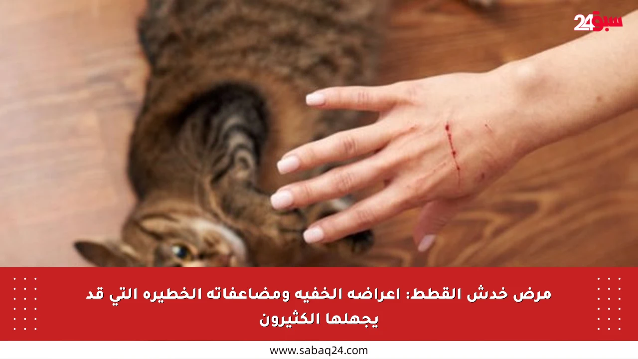 مرض خدش القطط: أعراضه الخفية ومضاعفاته الخطيرة التي قد يجهلها الكثيرون